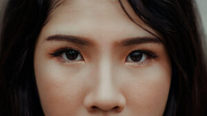 Brow Lift and Forehead Elevation