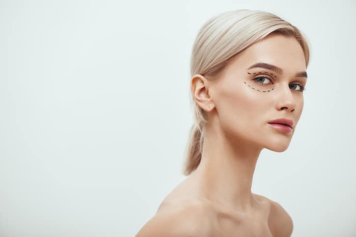 Perfection. Beautiful and young blonde woman with black surgical lines on eyelids and under eyes looking at camera