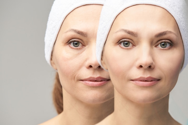 Pretty mature girl. Before and after portrait. Anti wrincle healthy therapy. Black circle under eyes. Collagen cream. Cosmetology rejuvenation. Beauty model. Procedure result